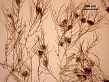 2 - Porzione subapicale di un gametofito con carposporofiti
